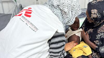 MSF treats malnutrition at Al Damazin Hospital