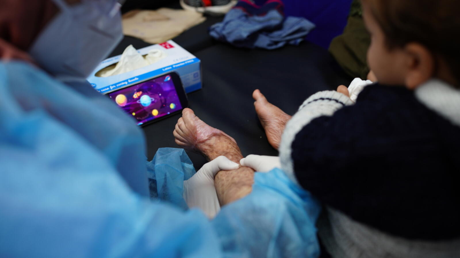 Burn Care in Gaza