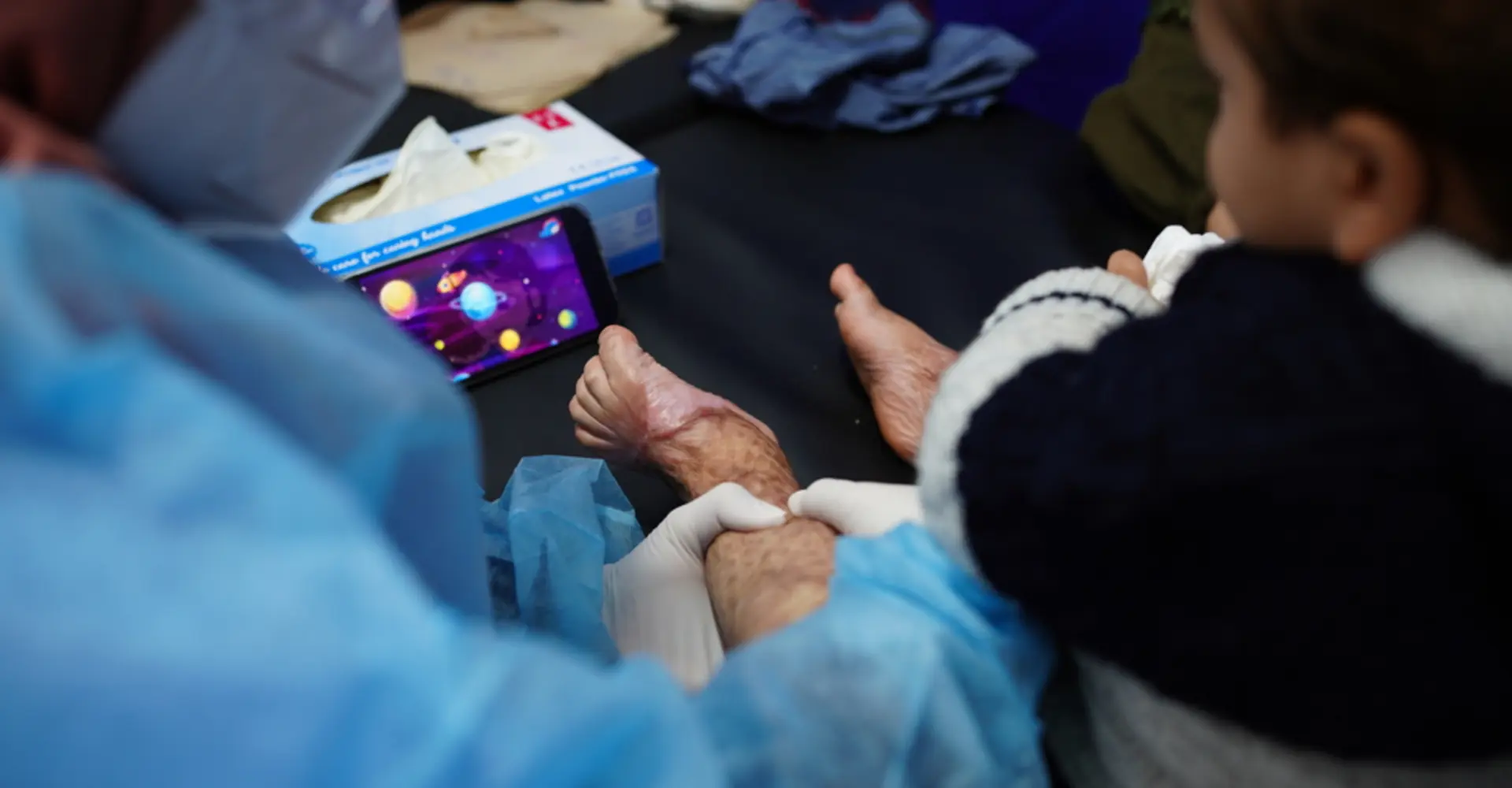 Burn Care in Gaza