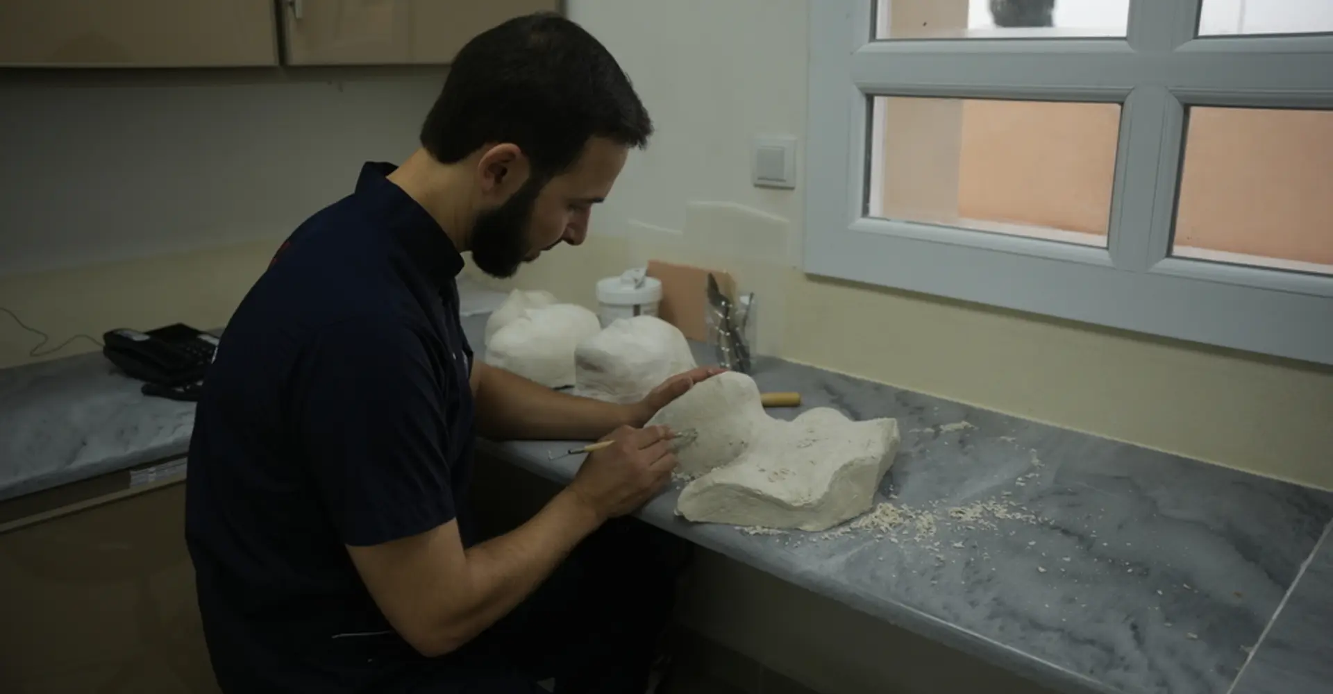 Huge needs for burns patients in Syrian camps