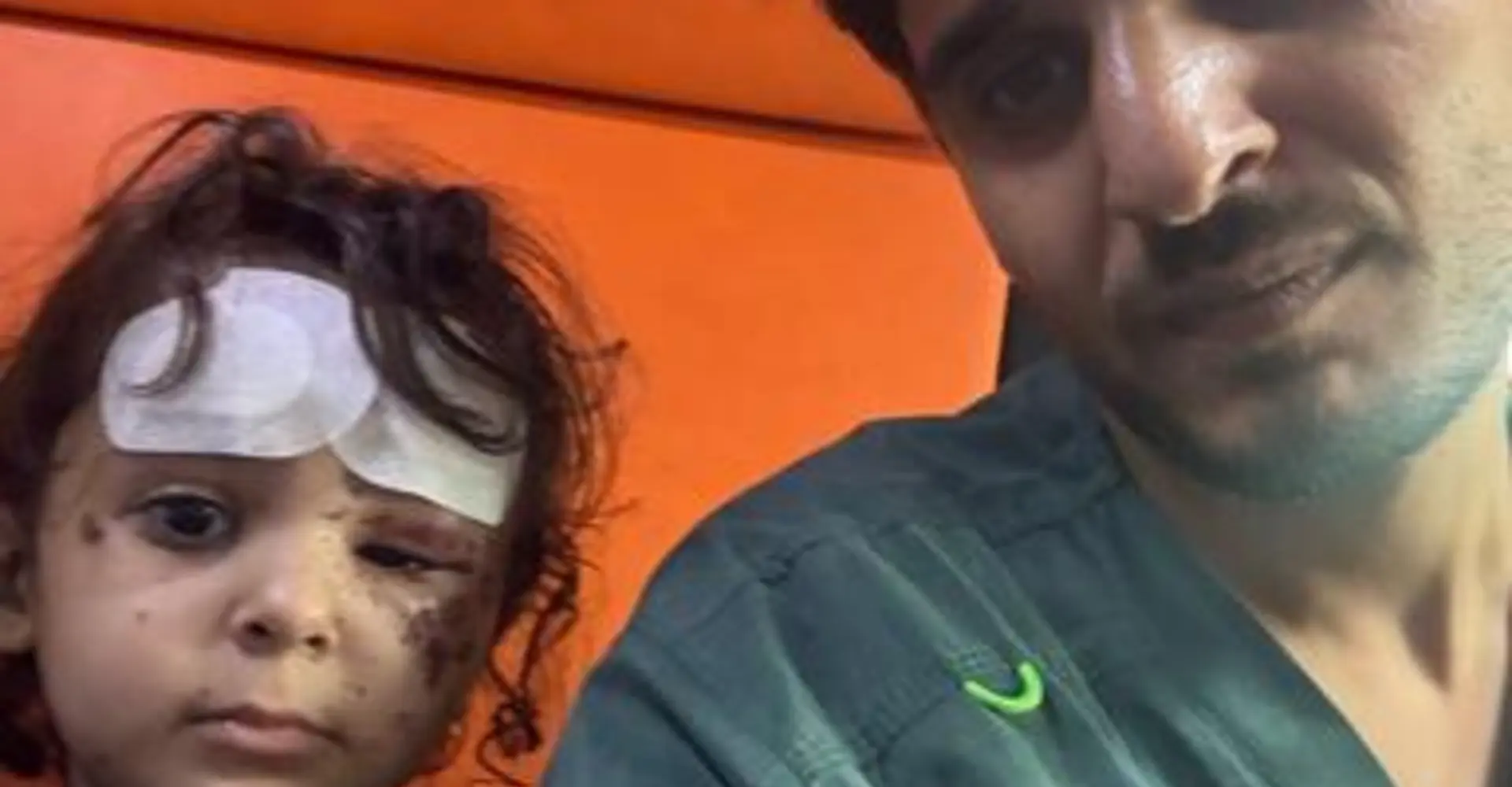 MSF Doctor Ahmed with his 4-year-old daughter Julia as they were being evacuated From Al Quds Hospital to Al Aqsa Hospital after being injured in an airstrike on their home in Gaza City.