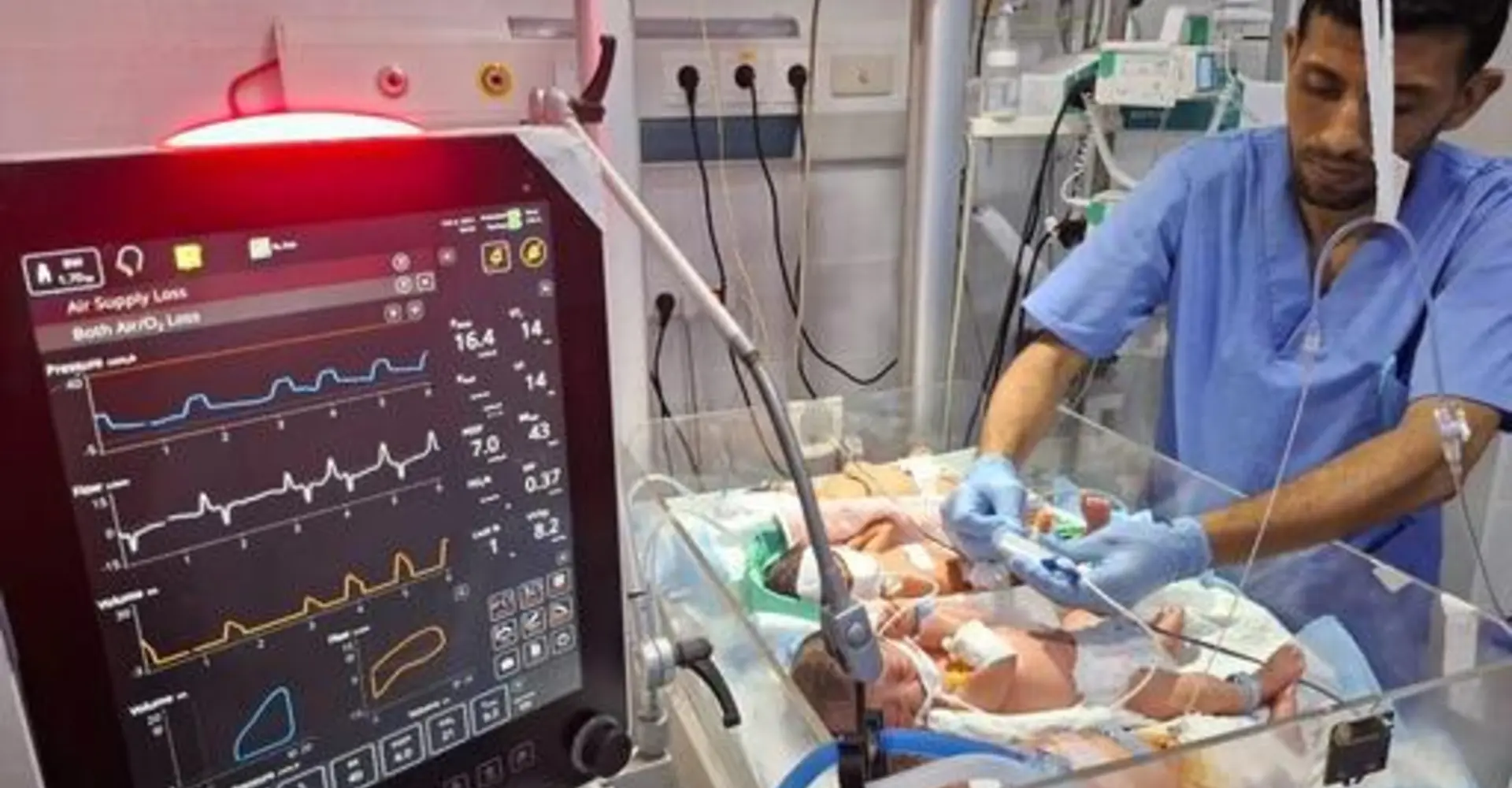  Premature newborns north Gaza