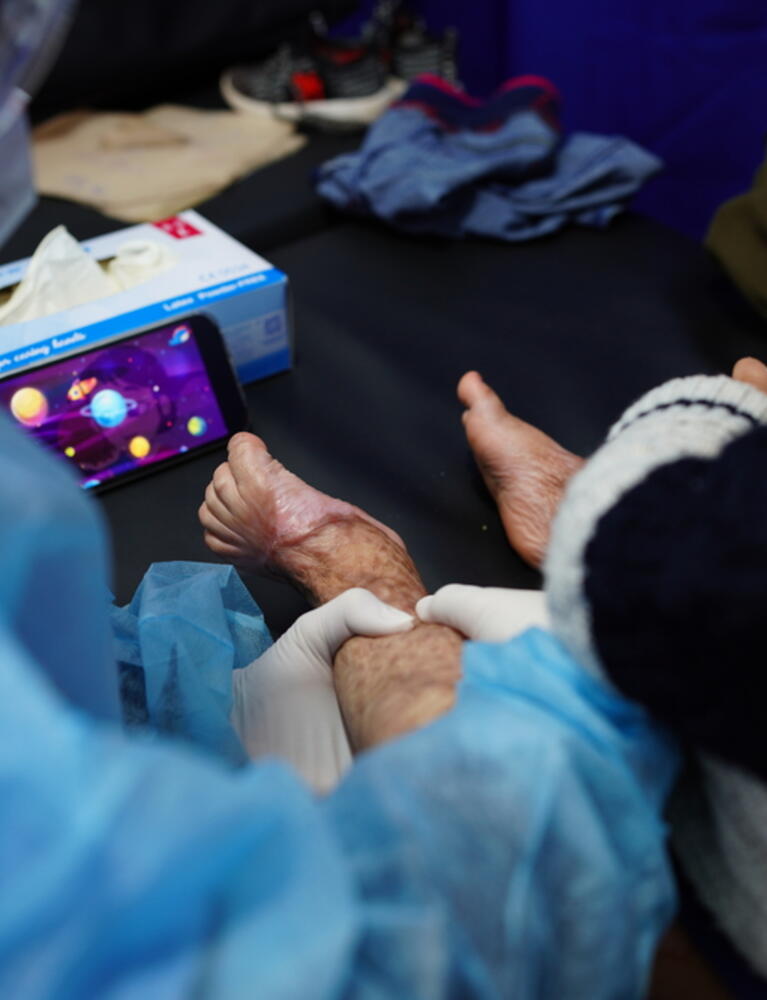 Burn Care in Gaza